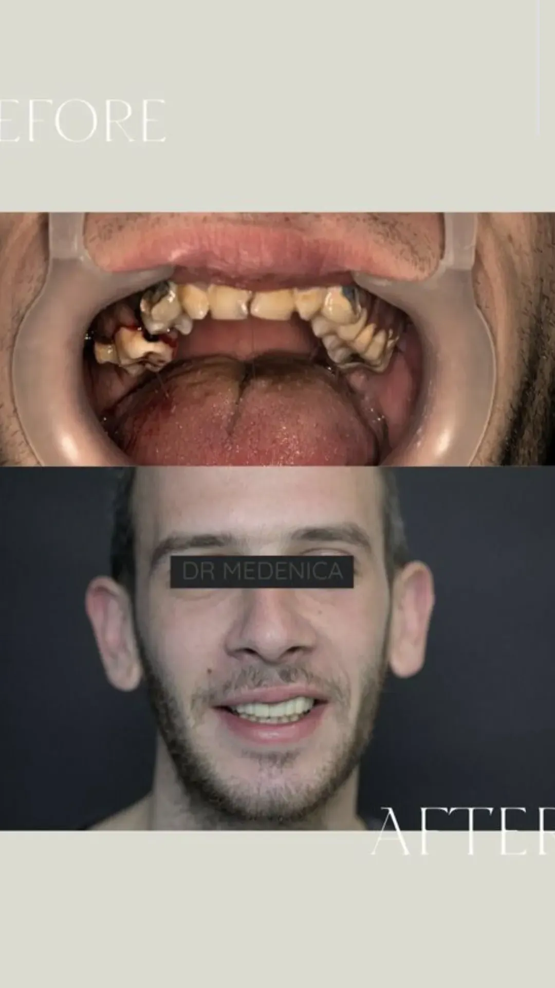 Protetika 3